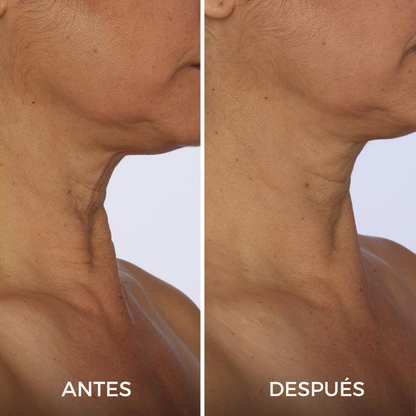 Crema reafirmante para cuello - Realza y define