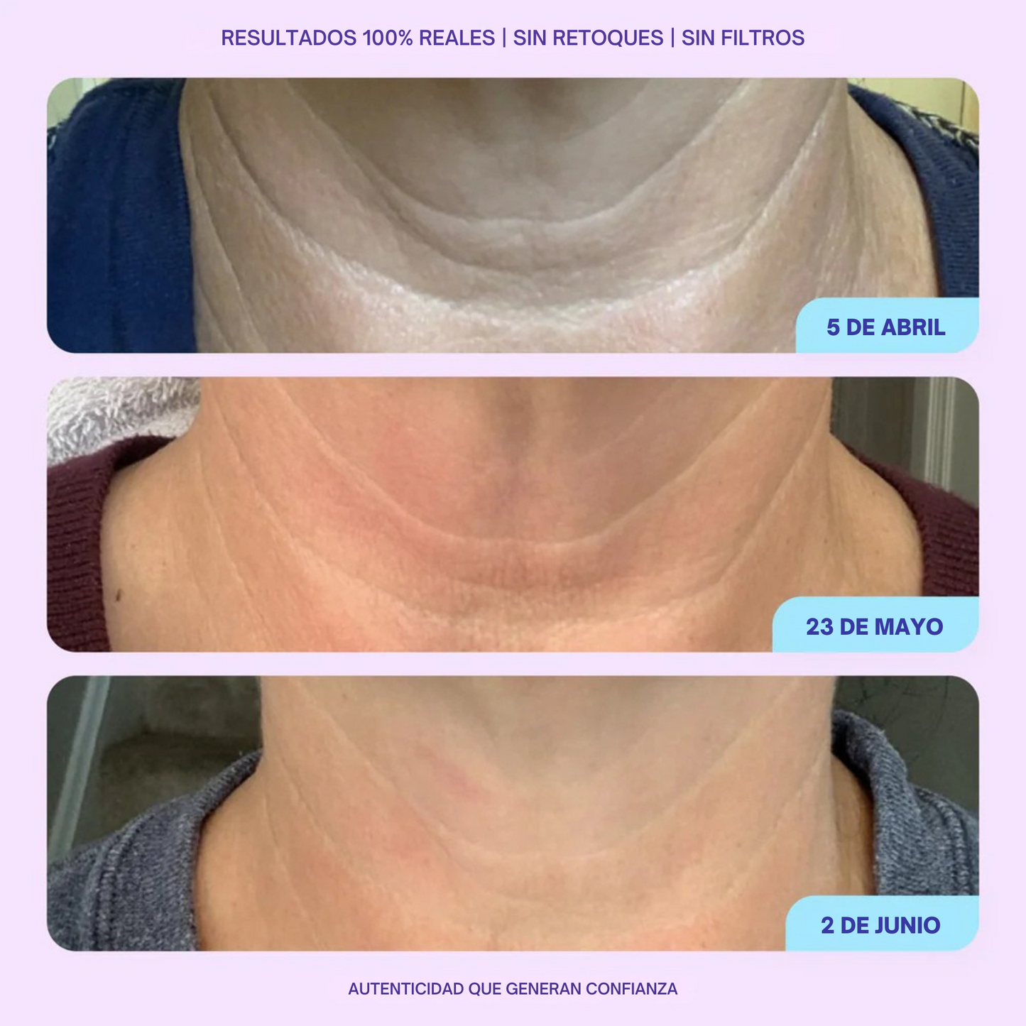 Crema reafirmante para cuello - Realza y define