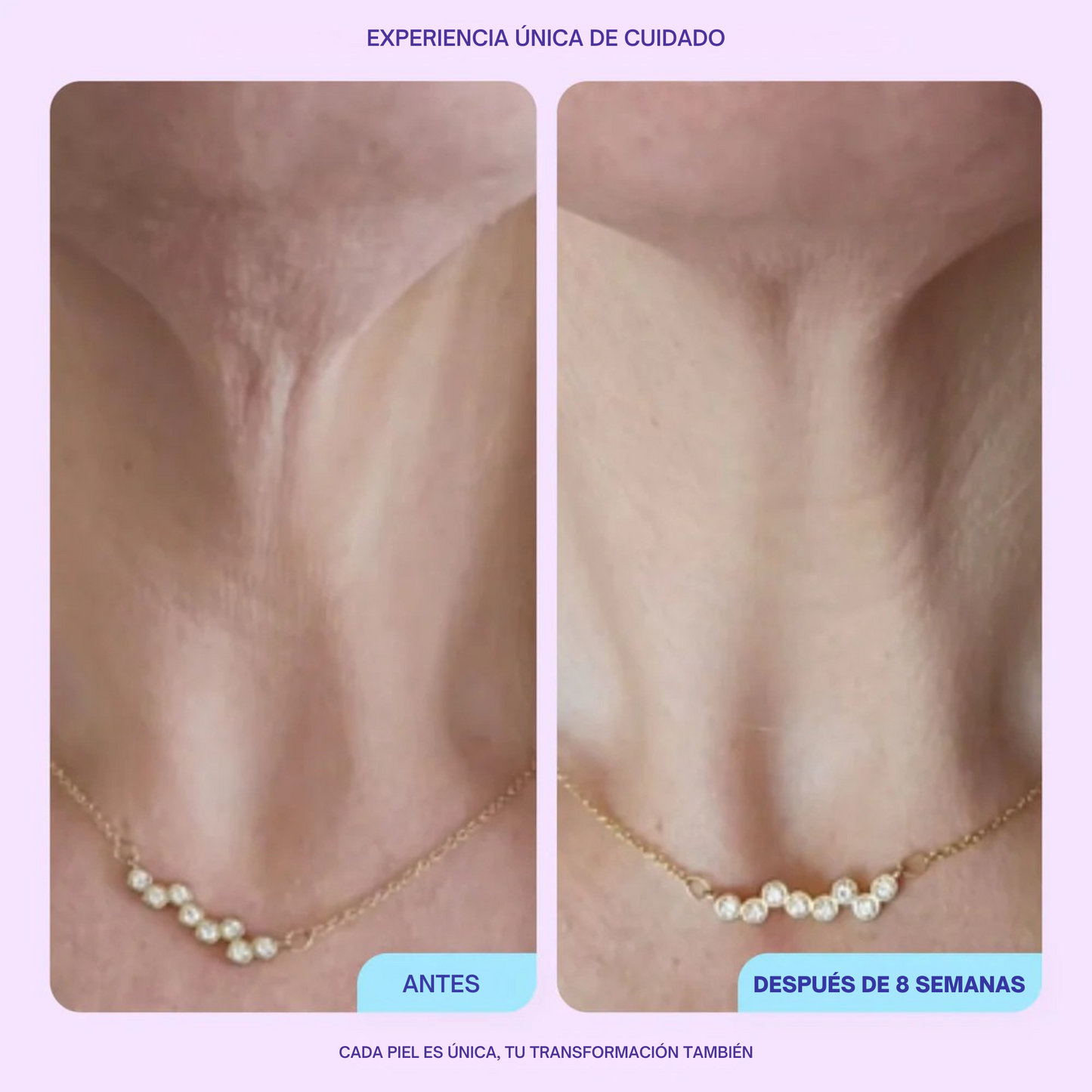 Crema reafirmante para cuello - Realza y define