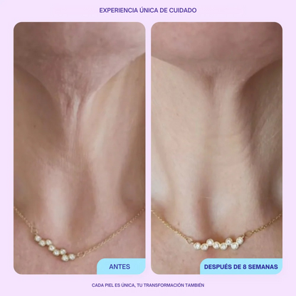 Crema reafirmante para cuello - Realza y define