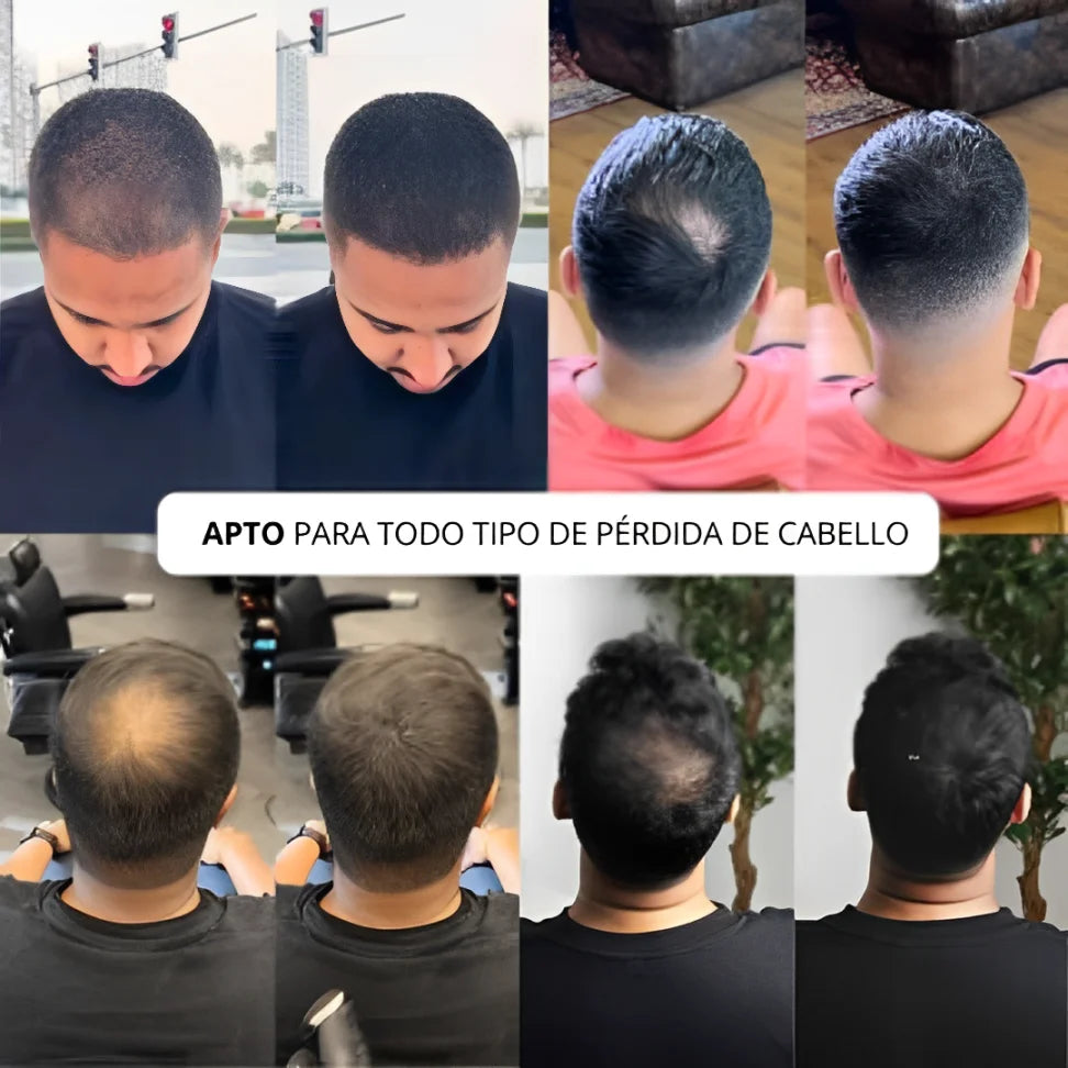 Polvo Capilar Voluminizador – Edición Limitada 2025